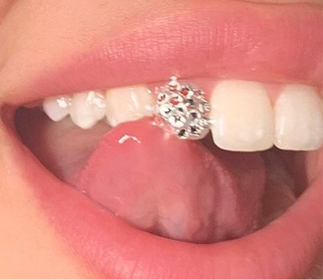 Disco ball 2025 tooth gem